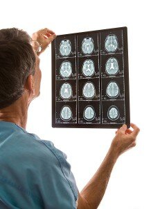 Stroke Prevention Centers on Two Factors